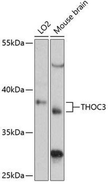 Epigenetics and Nuclear Signaling Antibodies 1 Anti-THOC3 Antibody CAB13230