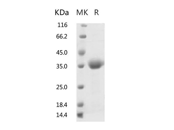 Recombinant 2019-nCoV Spike Protein RBD