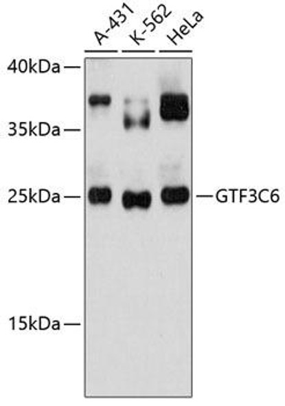 Epigenetics and Nuclear Signaling Antibodies 1 Anti-GTF3C6 Antibody CAB13233