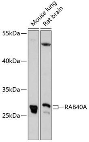 Signal Transduction Antibodies 1 Anti-RAB40A Antibody CAB13236