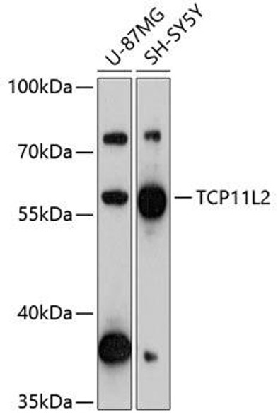 Cell Biology Antibodies 3 Anti-TCP11L2 Antibody CAB13239
