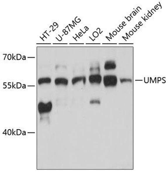 Metabolism Antibodies 1 Anti-UMPS Antibody CAB13251