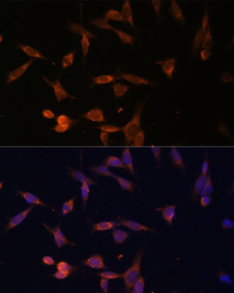 Metabolism Antibodies 1 Anti-UMPS Antibody CAB13251