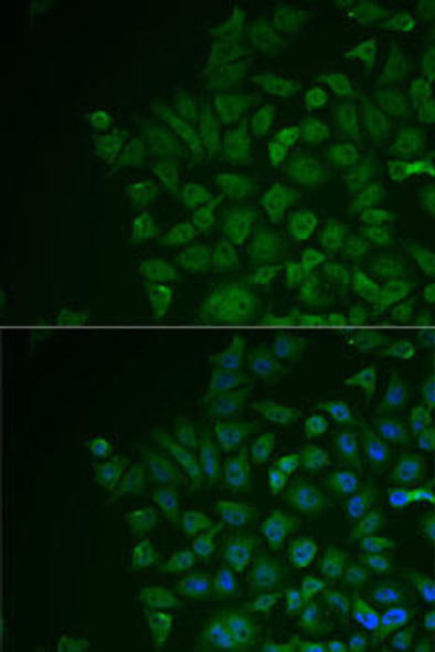 Signal Transduction Antibodies 1 Anti-LRAT Antibody CAB13256