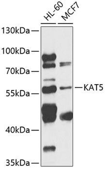 Developmental Biology Anti-KAT5 Antibody CAB13259