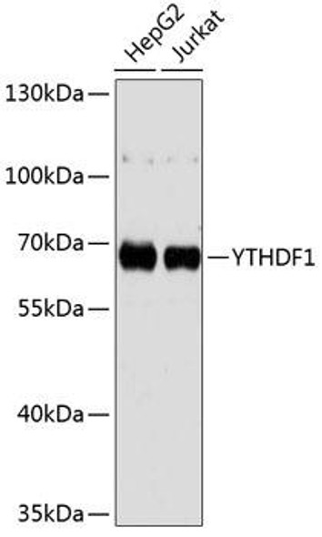 Immunology Antibodies 1 Anti-YTHDF1 Antibody CAB13260