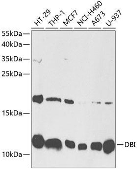 Signal Transduction Antibodies 1 Anti-DBI Antibody CAB13293