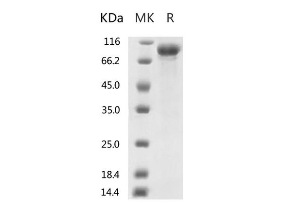 Recombinant 2019-nCoV S2 Protein mFc Tag