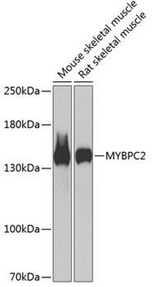 Cell Biology Antibodies 3 Anti-MYBPC2 Antibody CAB13331