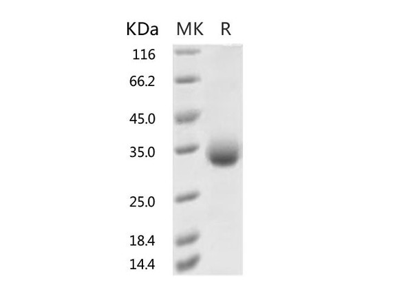 Recombinant 2019-nCoV Spike Protein RBD, His TagV367F