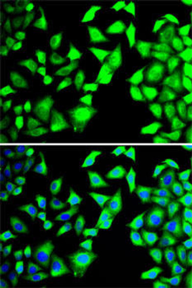 Metabolism Antibodies 1 Anti-EIF3H Antibody CAB13378