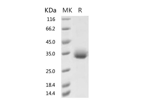 Recombinant 2019-nCoV Spike Protein RBD, His TagN354D