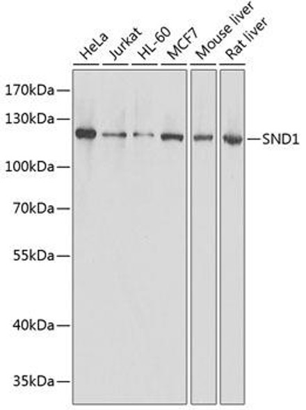 KO Validated Antibodies 1 Anti-SND1 Antibody CAB13415KO Validated