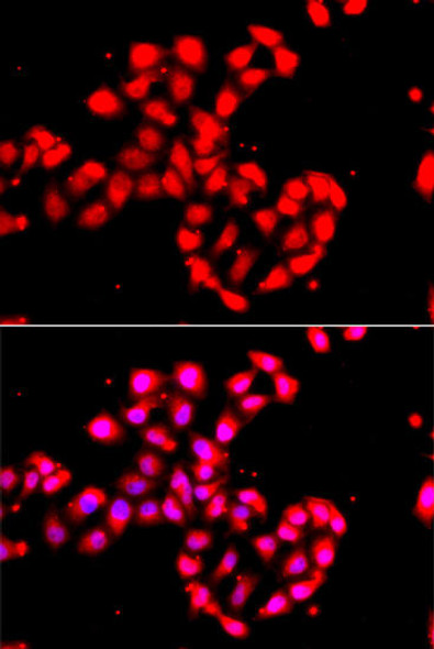 Immunology Antibodies 1 Anti-CAMK1D Antibody CAB13435