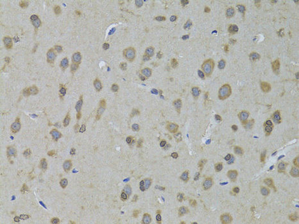 Cell Biology Antibodies 4 Anti-ADH5 Antibody CAB13459