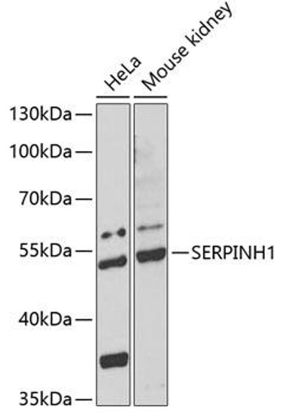 Metabolism Antibodies 1 Anti-SERPINH1 Antibody CAB13474