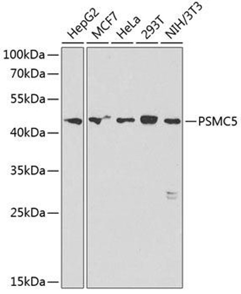 Cell Biology Antibodies 4 Anti-PSMC5 Antibody CAB13537