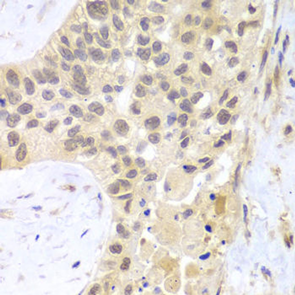 Cell Biology Antibodies 4 Anti-PSMC5 Antibody CAB13537