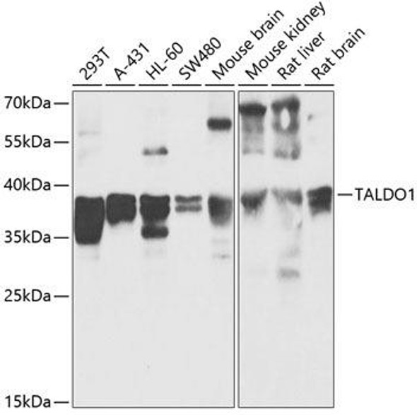 Metabolism Antibodies 1 Anti-TALDO1 Antibody CAB13551