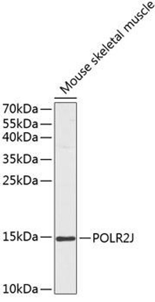 Epigenetics and Nuclear Signaling Antibodies 1 Anti-POLR2J Antibody CAB13627