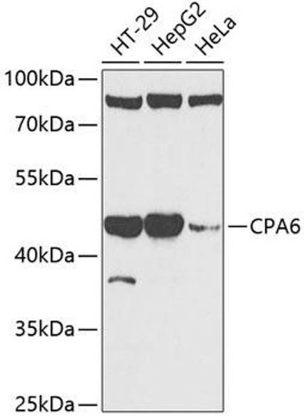 Cell Biology Antibodies 4 Anti-CPA6 Antibody CAB13644