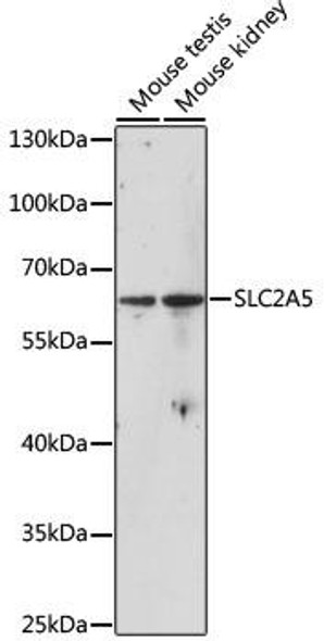 Signal Transduction Antibodies 1 Anti-SLC2A5 Antibody CAB13650