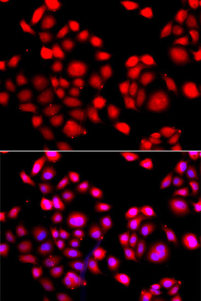 Epigenetics and Nuclear Signaling Antibodies 1 Anti-PRDM14 Antibody CAB13658