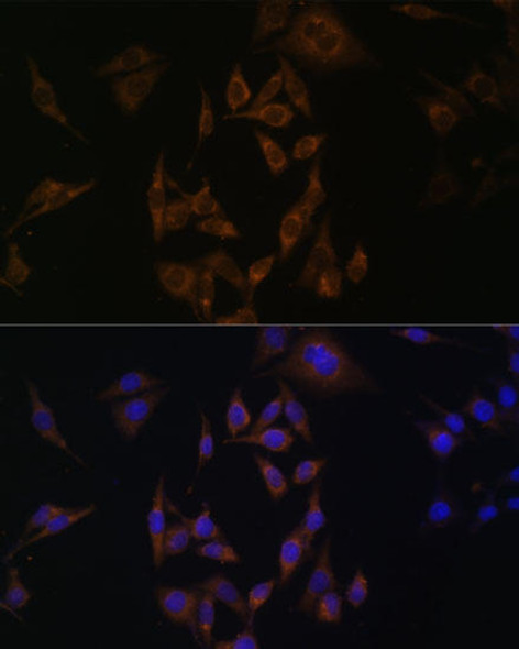 Signal Transduction Antibodies 1 Anti-UBE2L6 Antibody CAB13670