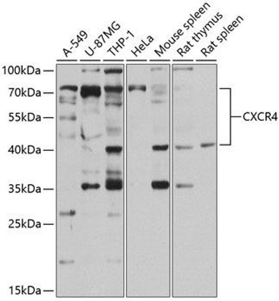 Immunology Antibodies 1 Anti-CXCR4 Antibody CAB13672