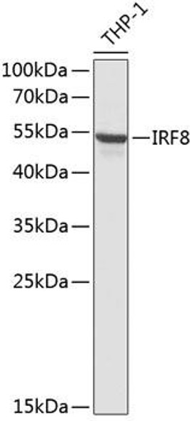 Autophagy Antibodies Anti-IRF8 Antibody CAB13677