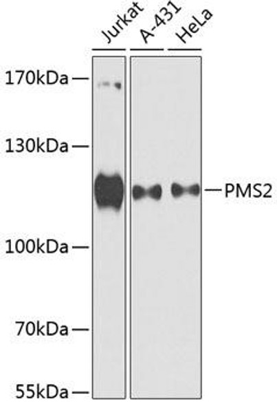 Epigenetics and Nuclear Signaling Antibodies 1 Anti-PMS2 Antibody CAB13680