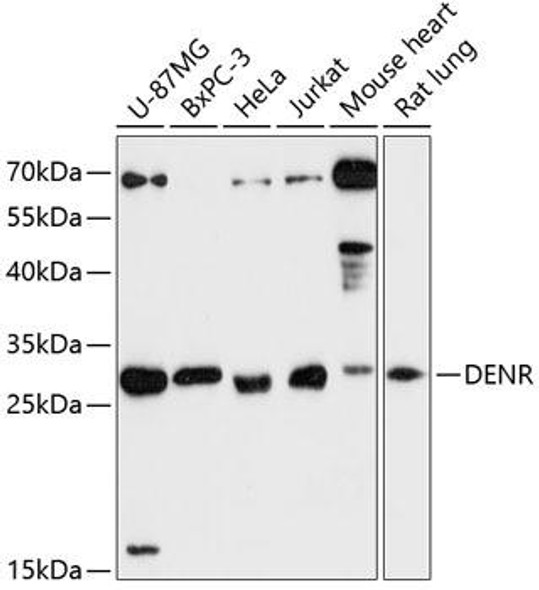 Metabolism Antibodies 1 Anti-DENR Antibody CAB13699