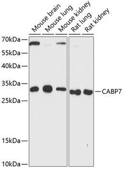 Cell Biology Antibodies 4 Anti-CABP7 Antibody CAB13703