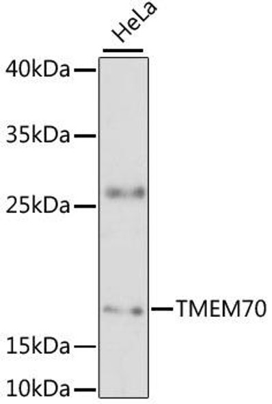 Cell Biology Antibodies 4 Anti-TMEM70 Antibody CAB13712