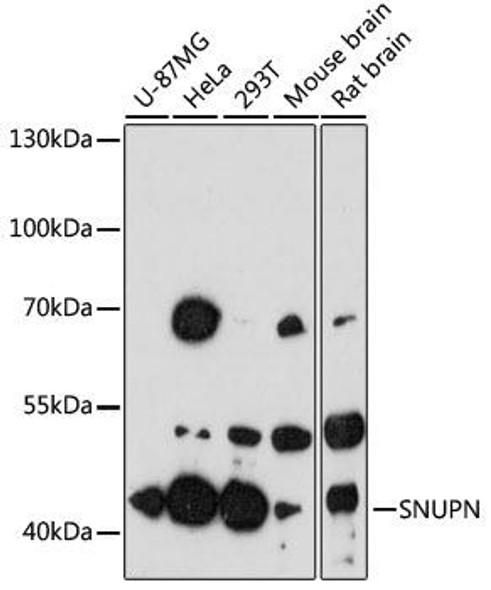 Signal Transduction Antibodies 1 Anti-SNUPN Antibody CAB13736