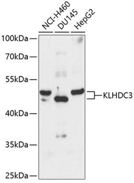 Cell Biology Antibodies 4 Anti-KLHDC3 Antibody CAB13741