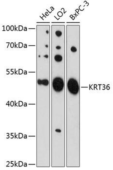 Cell Biology Antibodies 4 Anti-KRT36 Antibody CAB13759