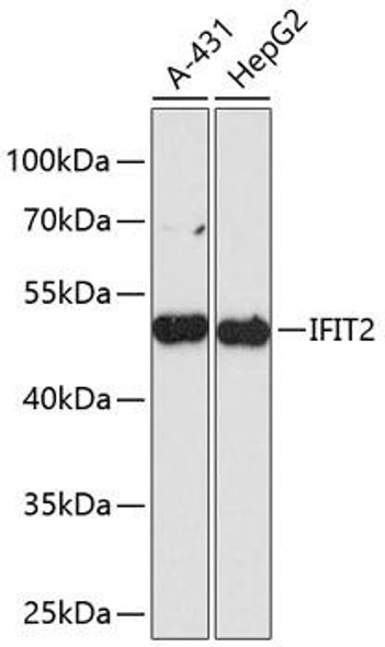 Immunology Antibodies 1 Anti-IFIT2 Antibody CAB13760