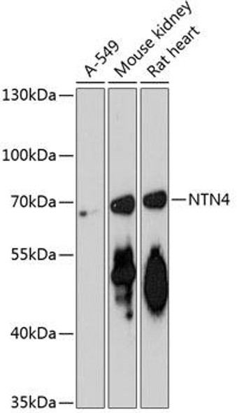 Cell Biology Antibodies 4 Anti-NTN4 Antibody CAB13775