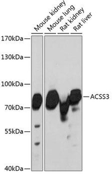 Cell Biology Antibodies 4 Anti-ACSS3 Antibody CAB13781