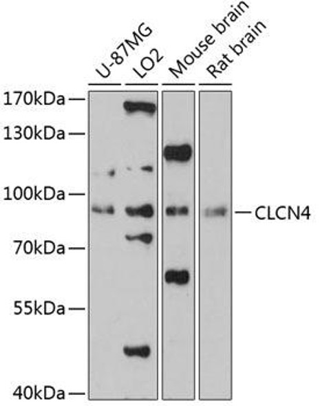 Signal Transduction Antibodies 1 Anti-CLCN4 Antibody CAB13790