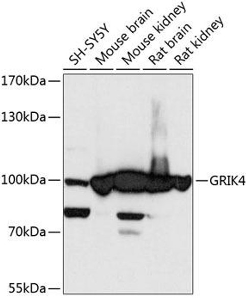 Signal Transduction Antibodies 1 Anti-GRIK4 Antibody CAB13800