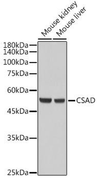 Cell Biology Antibodies 4 Anti-CSAD Antibody CAB13845