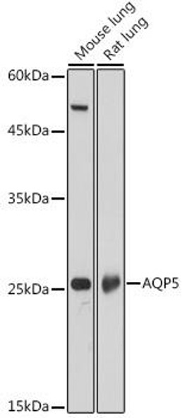 Signal Transduction Antibodies 1 Anti-AQP5 Antibody CAB13861