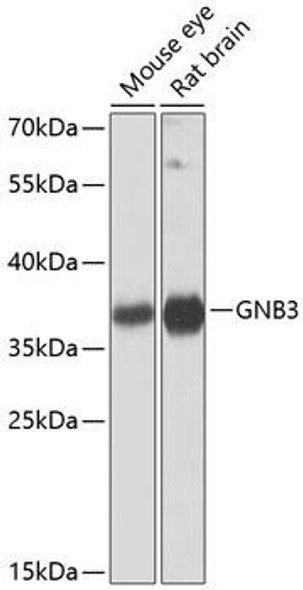 Cell Biology Antibodies 4 Anti-GNB3 Antibody CAB1387