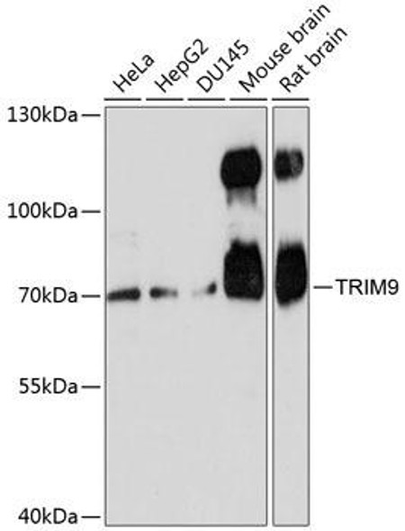 Signal Transduction Antibodies 1 Anti-TRIM9 Antibody CAB13896