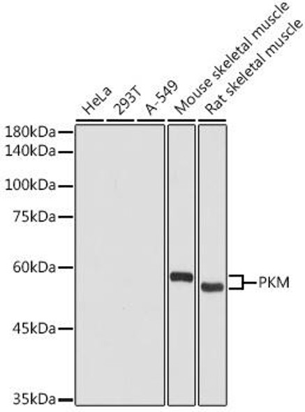 Metabolism Antibodies 1 Anti-PKM Antibody CAB13905