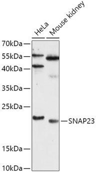 Cell Biology Antibodies 4 Anti-SNAP23 Antibody CAB13909