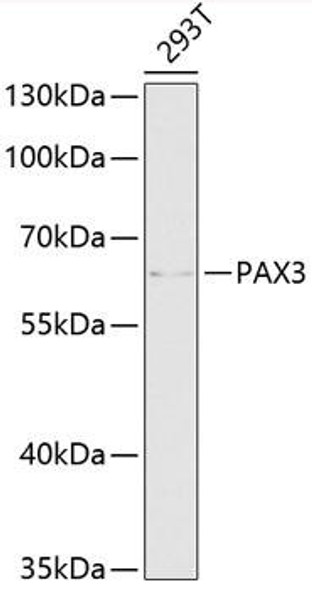 Cardiovascular Antibodies Anti-PAX3 Antibody CAB13930