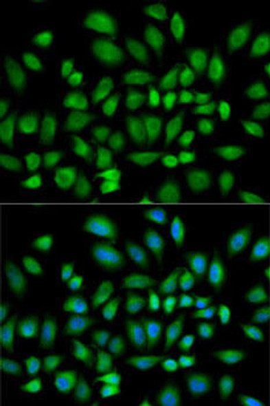 Cell Biology Antibodies 4 Anti-PDE4D Antibody CAB13937